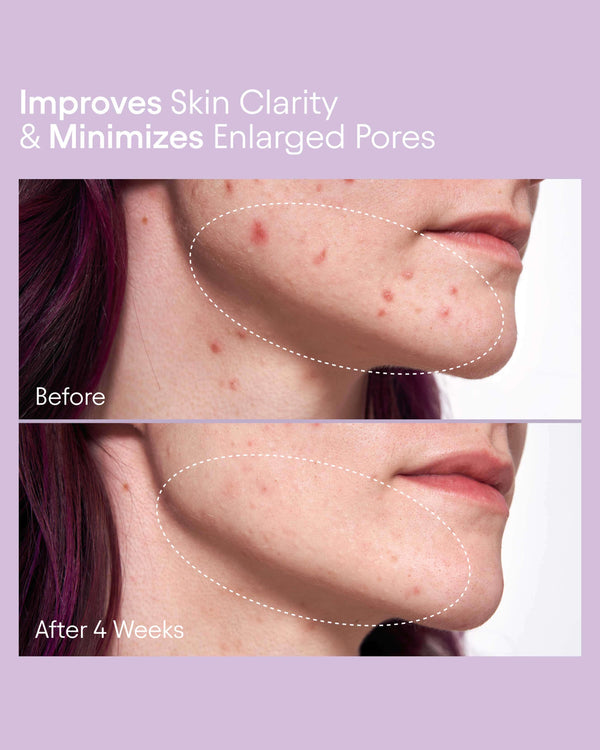 Pore Perfecting Liquid with 2% BHA + Borage