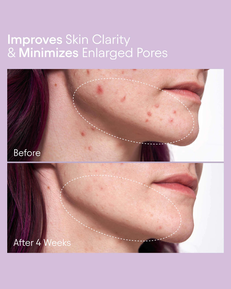 Pore Perfecting Liquid with 2% BHA + Borage